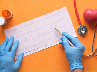 Pourquoi intégrer un ECG et une épreuve d’effort dans un bilan de santé pour dirigeant ?